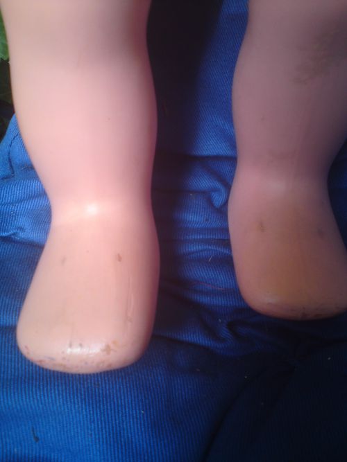 jambes de gégé marcheuses