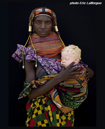 enfant-albinos1.jpg