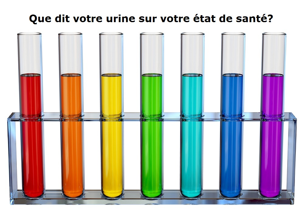 urine colour.jpg