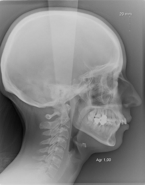 radiologie panoramique dentaire-coté.jpg