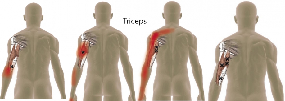 Triceps.jpg