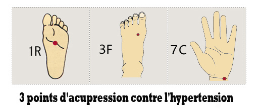 Points hypertension.jpg