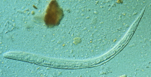 Strongyloides_stercoraliz_larva.jpg