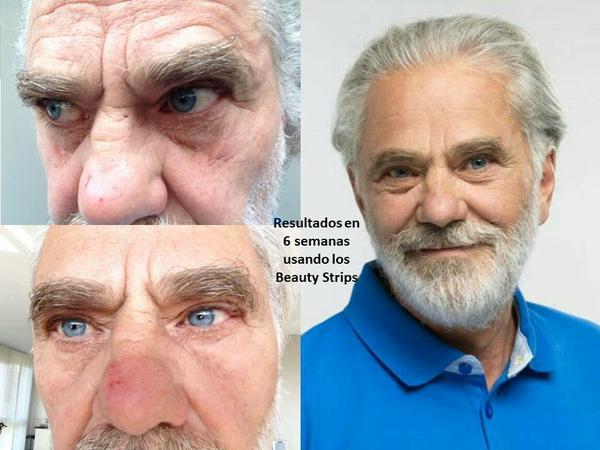 BeautyStrips-mens-face-Before-and-After.jpg