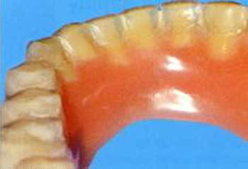 dentier 15.jpg