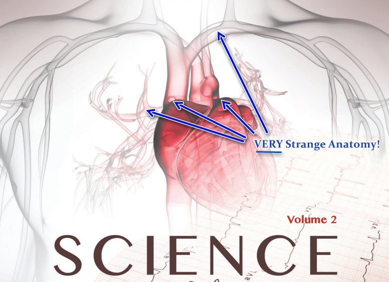 VERY Strange Cardiac Anatomy.jpg