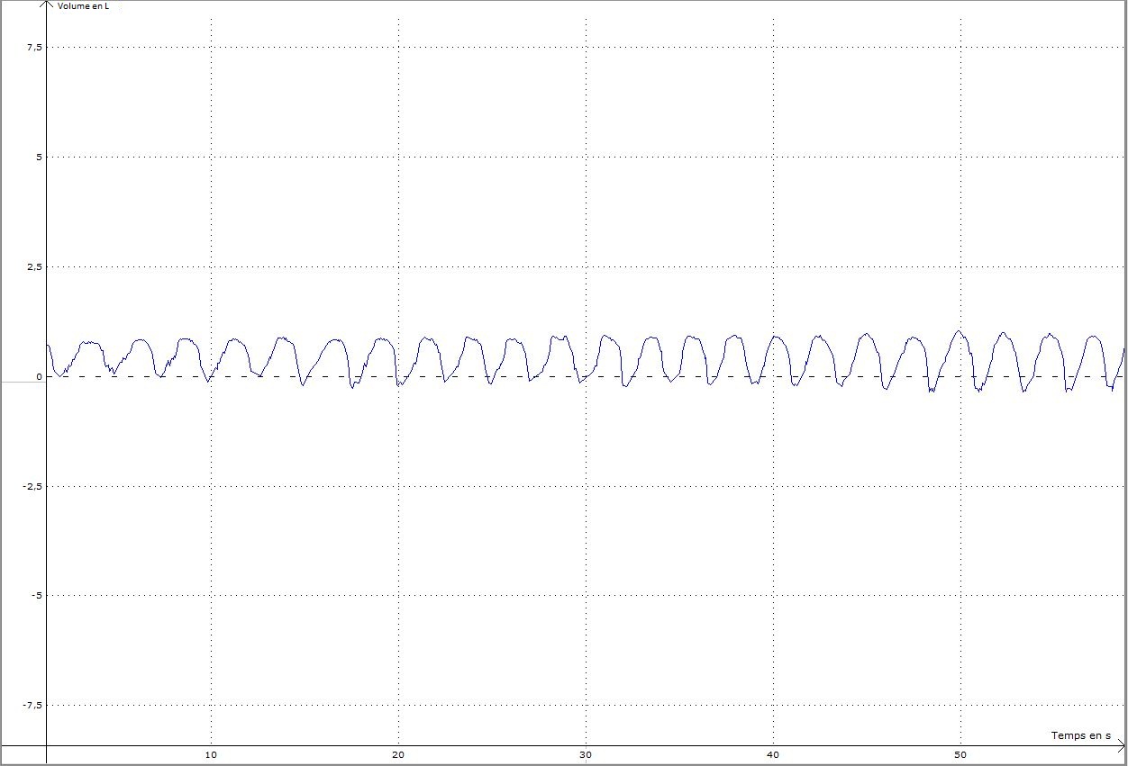 Capture courbge asthma ss effort + ventoline.JPG