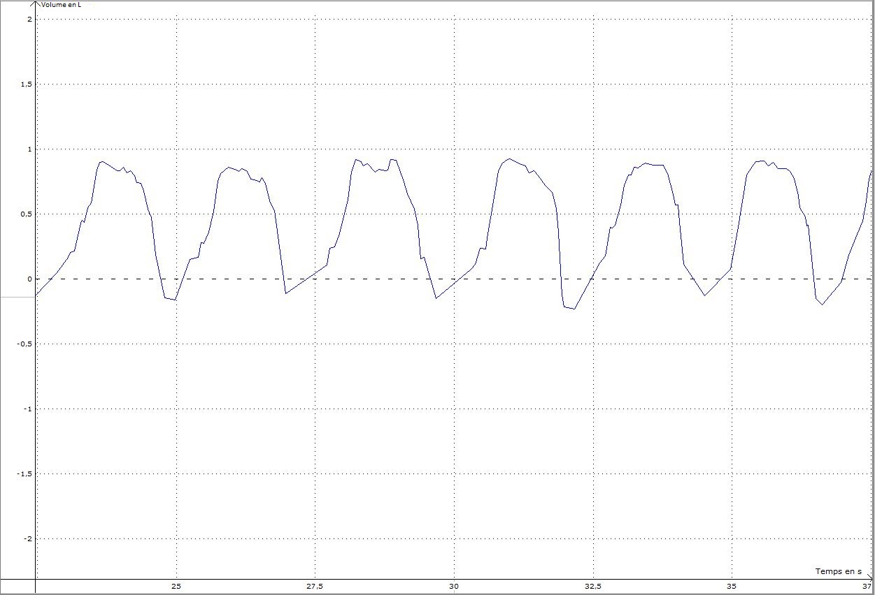 Capture courbge asthma ss effort + ventoline plus précise.JPG