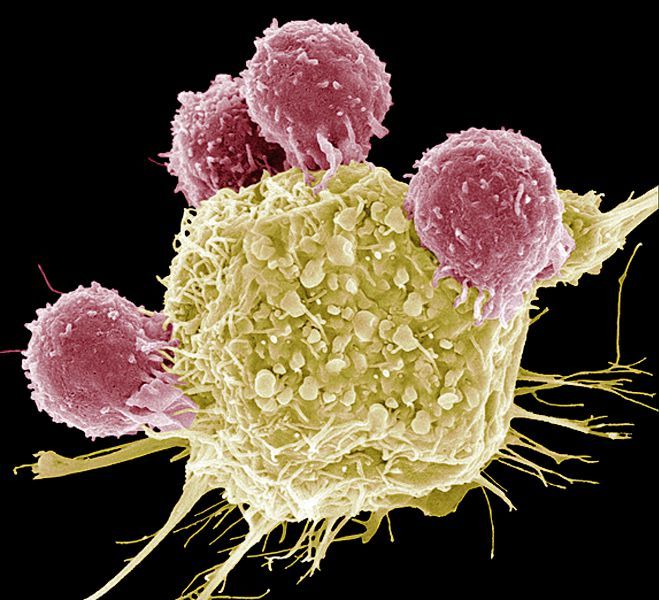 0 - LT et cellules cancéreuses.jpg