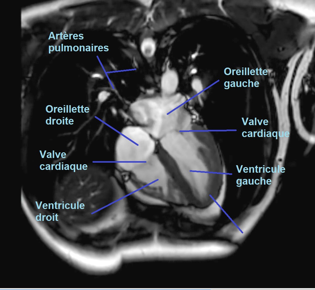 IRM image 2.jpg
