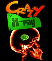 Crazy Xray.jpg