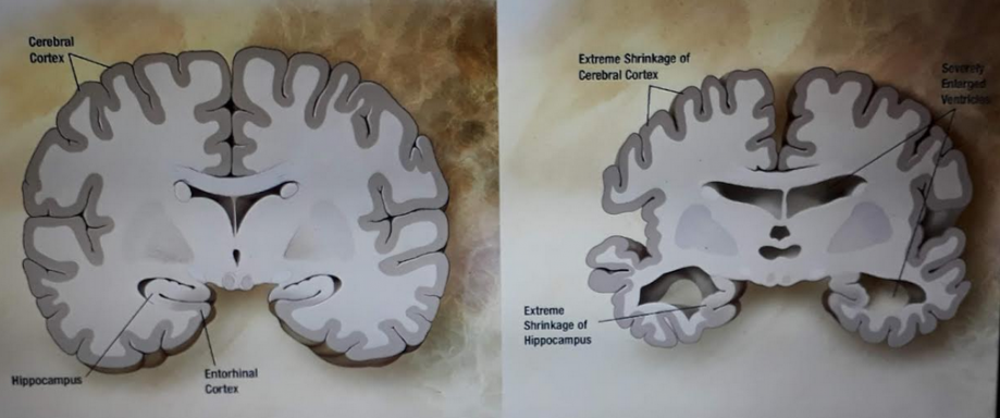 structure du cerveau